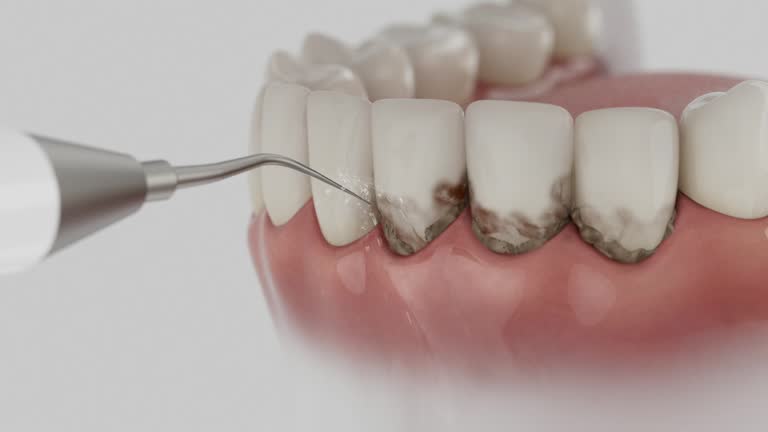 Reliable Dental contractor in St. John, MO by Smile Center Dentistry